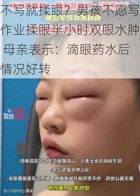 不写就揉眼？男孩不愿写作业揉眼半小时双眼水肿 母亲表示：滴眼药水后情况好转